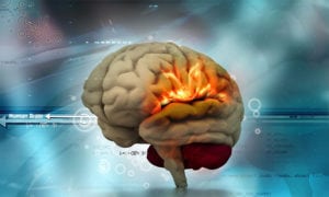 Fosfenos, cerebro triuno y test kinesiológico